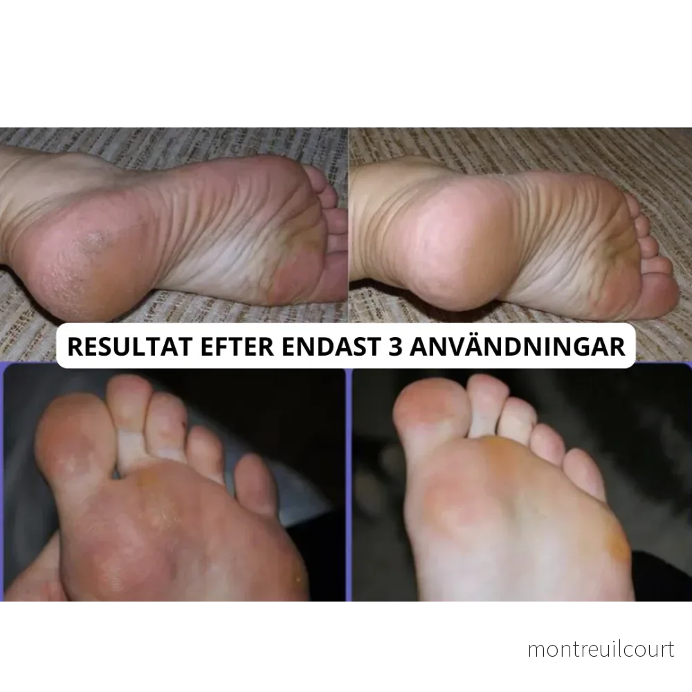Elektrisk Fotfil Pro - Bild 2